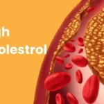 Signs You May Have High Cholesterol High-Cholestrol-930x620-1