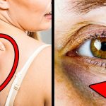 8 Signs You Have Too Much Sugar in Your Body 00686154c2bdf9663054d85ae1
